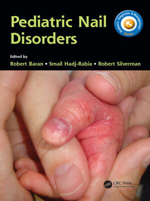 cover image of Pediatric Nail Disorders